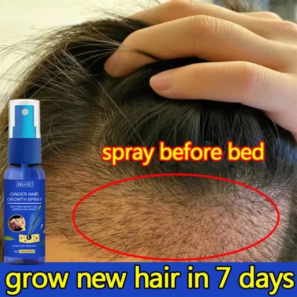 Hair Care Products - สเปรย์เร่งผมยาวขึ้นอย่างรวดเร็ว บำรุงรากผม ป้องกันผมร่วง เซรั่มปลูกผมใหม่ ซ่อมแซมหนังศีรษะที่เสียหาย บำรุงและดูแลเส้นผม
