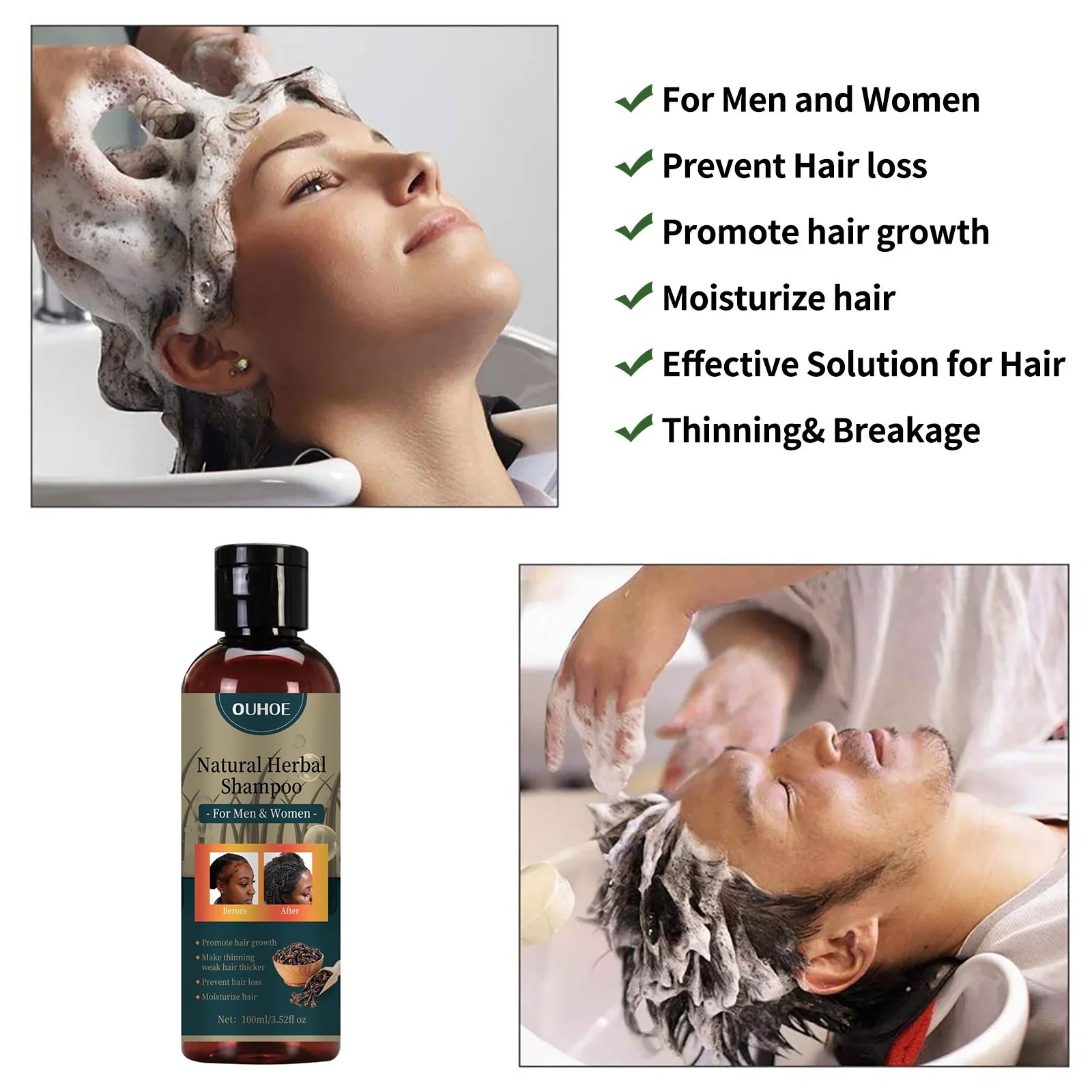 แชมพู OUHOE สำหรับเร่งผมยาว ขจ - Hair Care Dandruff บทวิจารณ์และราคา