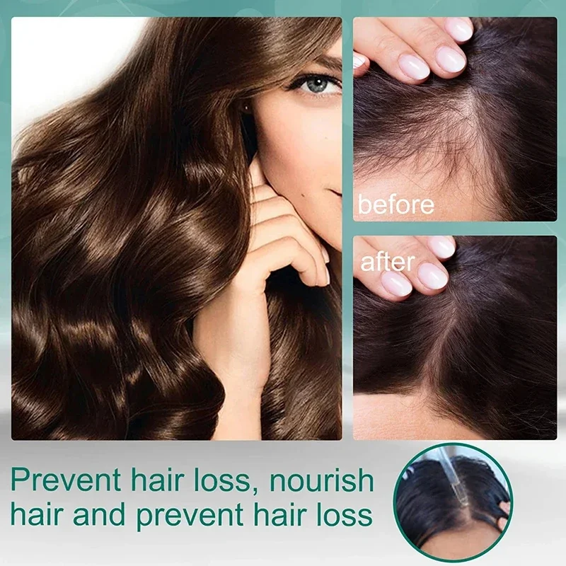 ทรีทเม้นต์ลิควิดสี่สมุนไพร ส่ว - Hair Care Natural Ingredients บทวิจารณ์และราคา