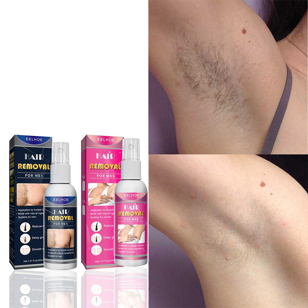 1/2PCS Super NATURAL ไม่เจ็บปว - Hair Care Lotion บทวิจารณ์และราคา
