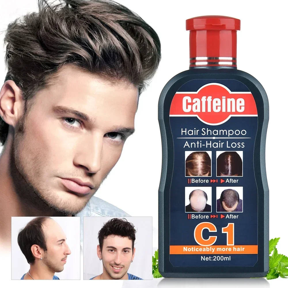 ผู้ชายแชมพูสําหรับ Hair Growth - Hair Care Korean Products บทวิจารณ์และราคา